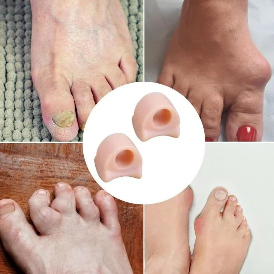 👣 Silicone Gel Toe Separator Ring (1 Pair) – Pain Relief & Foot Care