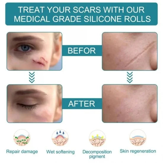 Silicone Scar Removal Sheet – Smooth & Heal Skin | Personal Care