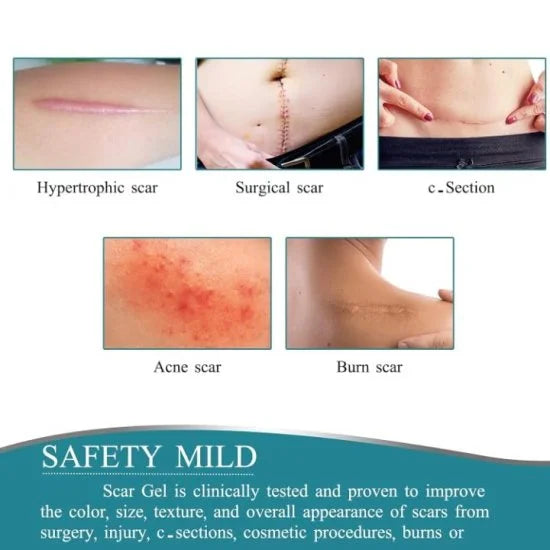 Silicone Scar Removal Sheet – Smooth & Heal Skin | Personal Care