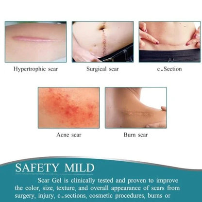 Silicone Scar Removal Sheet – Smooth & Heal Skin | Personal Care