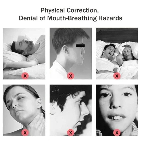 Anti-Snoring Lip Strips (30 Pcs) | Natural Sleep Aid | Comfortable & Skin-Safe