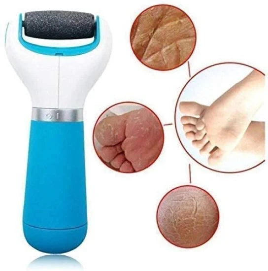 Pedicure Spin Foot Roller – Dead Skin & Callus Remover
