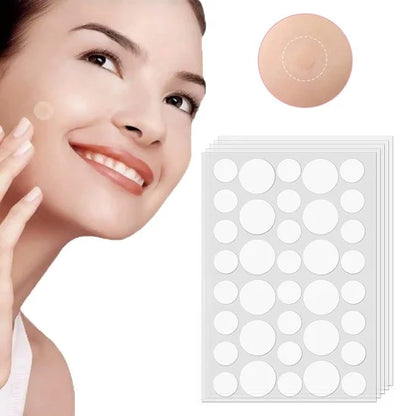 36 pcs Acne Patch – Pimple Healing Spot Treatment